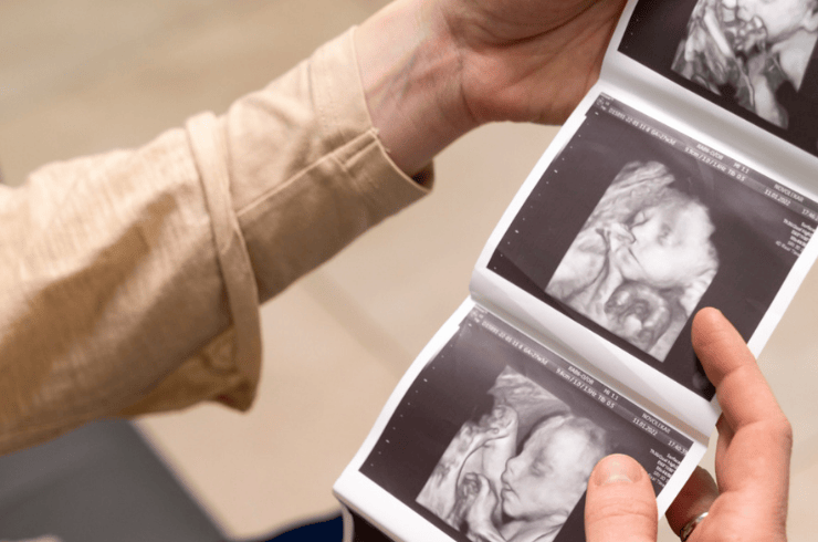 Fetal Medicine & Advanced Pregnancy Scans